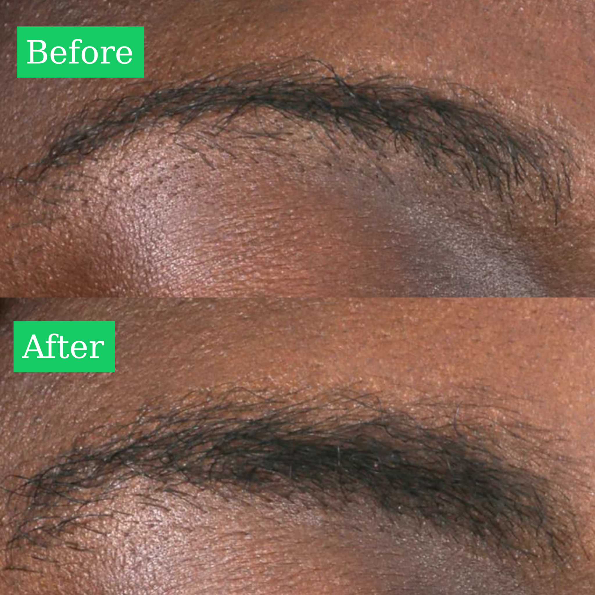 Before and After Results Using ALL-LASH Eyebrow Growth Serum for Fuller, Thicker and Healthier Looking Brows
