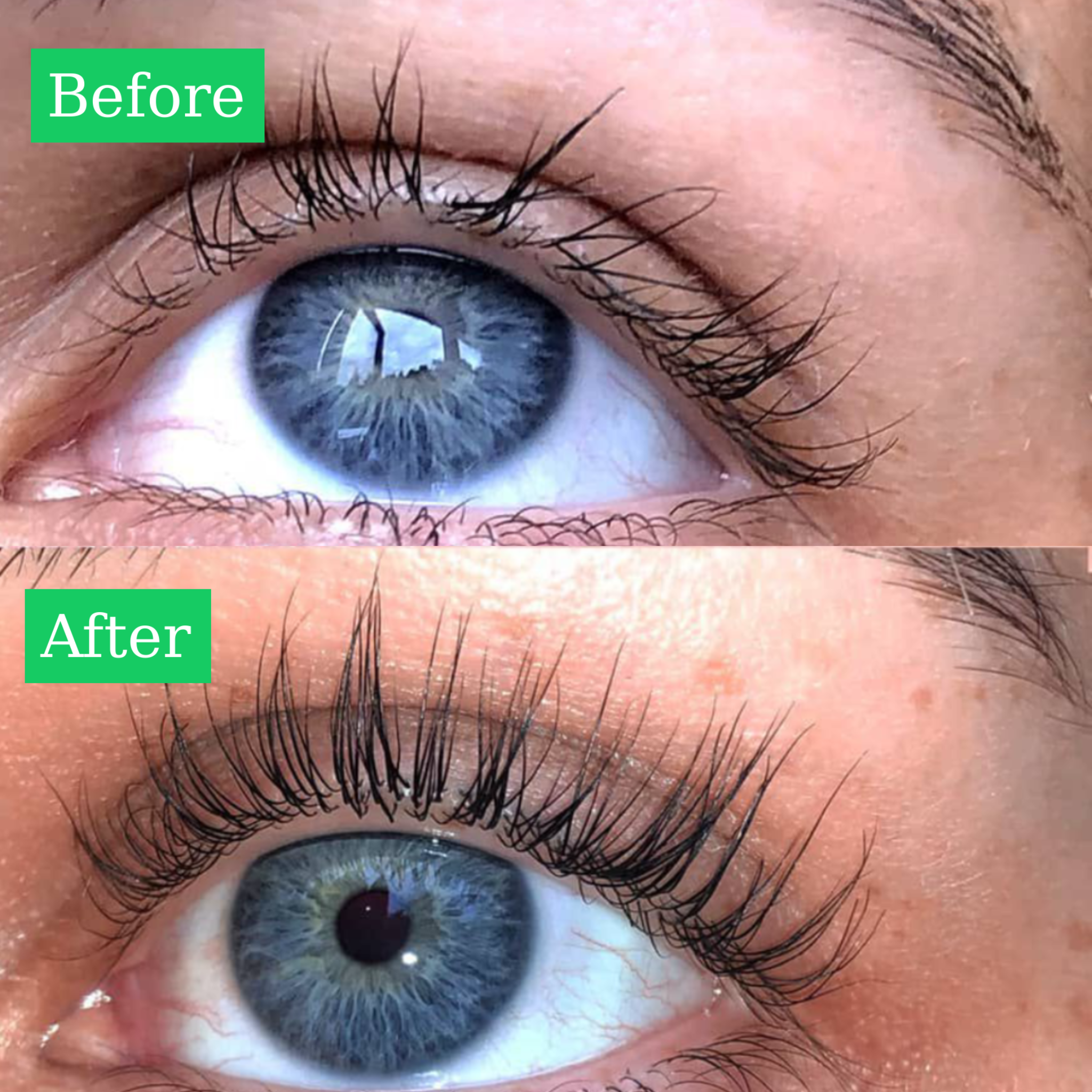 Before and After Results Using ALL-LASH Lash Growth Serum for Longer, Fuller and Healthier Looking Lashes